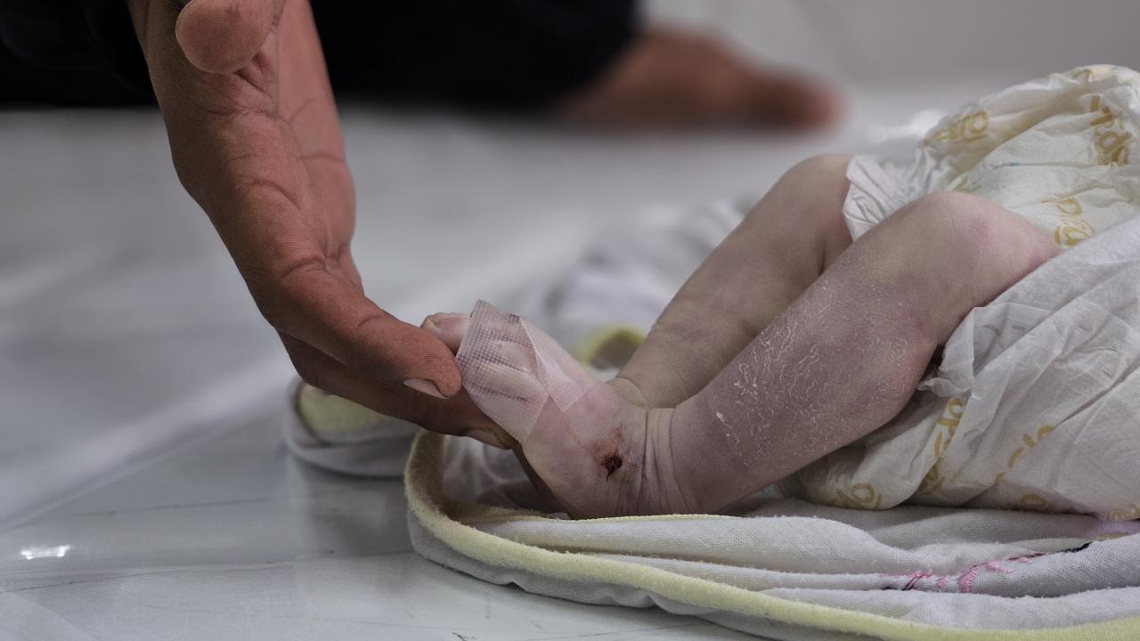 Gazze'de bir bebek daha açlıktan can verdi
