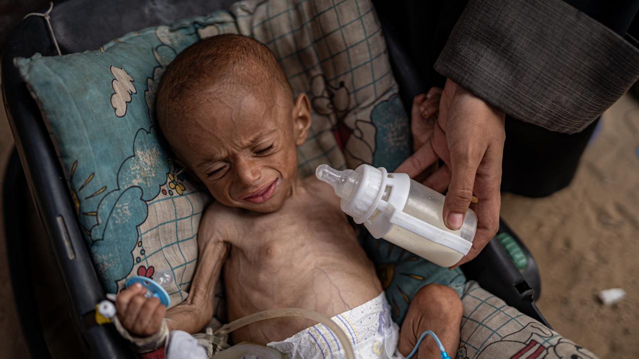 DSÖ: Gazze'de 4 bini çocuk 18 bin 500'den fazla hasta tıbbı tahliyeye ihtiyaç duyuyor