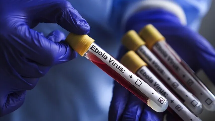 Ebola salgını büyüyor: Virüs mutasyona uğramış olabilir