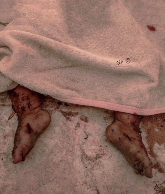 BM Yetkilisi: Refah'ta Çoluk Çocuk Diri Diri Yakıldı