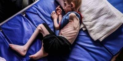 BM: Gazze'deki Bebeklerin Yüzde 92'si Temel Gıdalardan Yoksun