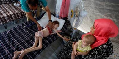 Gazze’de açlık nedeniyle can kaybı 113’e yükseldi