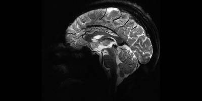 Pandemi beyinleri hızla yaşlandırdı