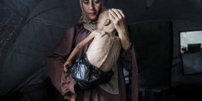 Gazze Açlıktan Ölüyor; Son 24 Saatte 4 Filistinli Daha Açlıktan Şehit Oldu