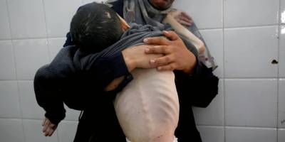 Katil İsrail'in kıtlığı dayattığı Gazze'de son 24 saatte 3 kişi daha açlıktan hayatını kaybetti