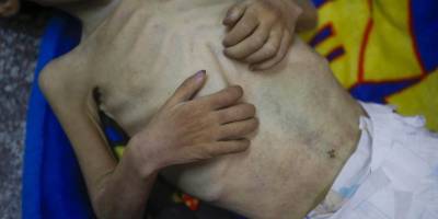 DSÖ: Gazze halkının aç bırakılması, İsrail'i daha güvenli hale getirmeyecek