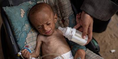 DSÖ: Gazze'de 4 bini çocuk 18 bin 500'den fazla hasta tıbbı tahliyeye ihtiyaç duyuyor