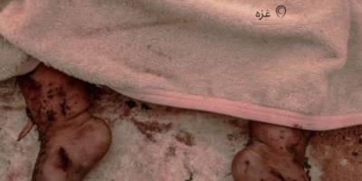 BM Yetkilisi: Refah'ta Çoluk Çocuk Diri Diri Yakıldı